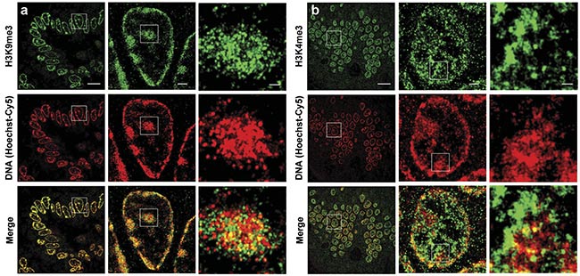 Figure 1. Two-color superresolution images of DNA and histone marks on mouse intestinal tissue. STORM images show the spatial relationship between DNA and the heterochromatin regions marked by H3K9me3 (histone 3 lysine 9 trimethylation) (a). STORM images show the spatial relationship between DNA and euchromatin regions marked by H3K4me3 (b). Scale bars: 10 µm, 1 µm, and 200 nm, respectively, in both the original and magnified images. Courtesy of the University of Pittsburgh.