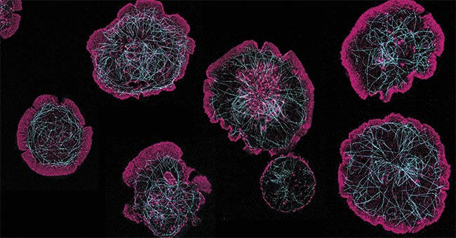 Figure 4. Rat basophils activating on a surface coated with rat immunoglobulin E. When the cell activates, actin (stained with Phalloidin-Atto 488) (pink) flows to the edges and causes the cell to spread and form a large contact with the glass surface. The microtubule network (stained with anti-tubulin Alexa Fluor 647) (cyan) reorganizes to facilitate the release of proinflammatory factors (e.g., histamine), which occurs during an allergic response. Courtesy of James Felce/ONI.