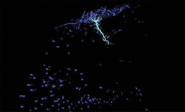 A place cell (cyan) and its local circuit of interneurons (dark blue) in a mouse hippocampus. Courtesy of Tristan Geiller/Losonczy Lab/Columbia’s Zuckerman Institute.