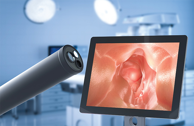 Figure 1. An endoscope and an image it provided. Courtesy of OMNIVISION.