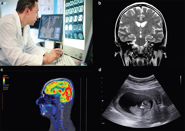Figure 2. An example image from each of the four traditional categories of diagnostic imaging: CT scan (a), MRI (b), PET (c), and ultrasound (d). Courtesy of OMNIVISION.