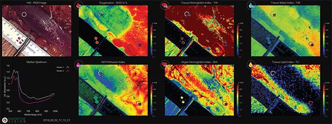 Figure 4. The visualization modes of the MALYNA endoscopic camera system. Courtesy of Diaspective Vision.