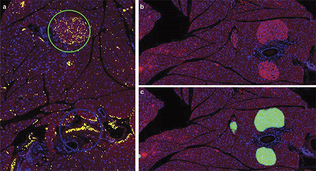 AI Bridges the Gap Between Medical Imaging and Analysis