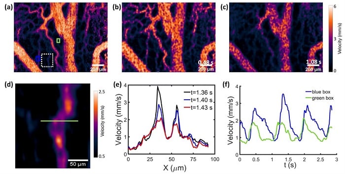 Laser Speckle Method Captures Blood Flow in Microvasculature