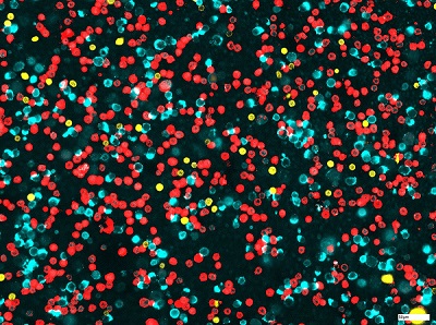 For chip cytometric analysis, the cells are applied onto a chip. Then they are stained using fluorescent dye labeled antibodies that specifically bind to certain markers on the surface of the cells. This allows researchers to differentiate effectively between monocytes (light blue), T cells (yellow) and neutrophil granulocytes (red), for example. Courtesy of Fraunhofer ITEM.