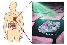 As part of an optical approach to cancer therapy, AR3, a light-activated protein from the rhodopsin family, is synthesized inside cancer cells and then light is applied, inducing cell apoptosis. Courtesy of Okayama University and JST.