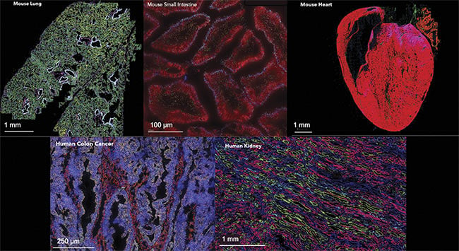 Figure 2. A massively multiplexed FISH technology was used to spatially profile the cells within numerous tissue types, including human and animal. The method reveals the location and quantity of hundreds of key RNA species within individual cells of the tissue with high accuracy and sensitivity, elucidating the heterogeneity and interdependency of all the tissues — based on cell type, cell shape, cell-cell interactions, and specific regions within the tissue. Courtesy of Vizgen.