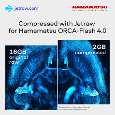Research sample from Wyss center for bio and Neuroengineering acquired on Hamamatsu's ORCA Flash 4.0 and compressed with Jetraw by Dotphoton. The two companies are collaborating to maximize the amount of data users can obtain from biomedical image captures. Courtesy of Hamamatsu Photonics via Wyss Center. 