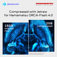 Research sample from Wyss center for bio and Neuroengineering acquired on Hamamatsu's ORCA Flash 4.0 and compressed with Jetraw by Dotphoton. The two companies are collaborating to maximize the amount of data users can obtain from biomedical image captures. Courtesy of Hamamatsu Photonics via Wyss Center.