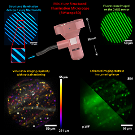 Researchers developed a head-mounted microscope that uses structured illumination to remove out-of-focus light with optical sectioning. This enables deep imaging while also enhancing image contrast in scattering tissue. Courtesy of Omkar D. Supekar, University of Colorado Boulder and Emily Gibson, University of Colorado Anschutz Medical Campus.
