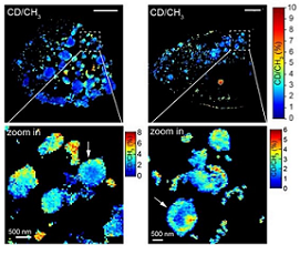Microscopy Methods Pair to Advance Nanoscale Superresolution Imaging