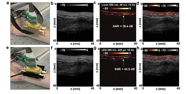 Figure 2. Comparison of LED- and laser-based photoacoustic in vivo vasculature imaging of the right-hand wrist of a healthy 25-year-old male human volunteer. The experimental setup, with the wrist placed inside a large water bath for laser-based photoacoustic imaging (a), and the images obtained via ultrasound (b), photoacoustic imaging (c), and co-registered ultrasound and photoacoustic imaging (d) for the setup shown in (a). The setup with LED arrays (e), and the images obtained via ultrasound (f), photoacoustic imaging (g), and co-registered ultrasound and photoacoustic imaging (h) for the setup shown in (e). SNR: signal-to-noise ratio. Adapted with permission from Reference 5.