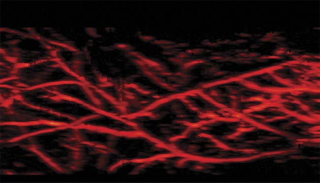 Photoacoustic Imaging Uses LED Light to Guide Cancer Diagnosis and Therapy