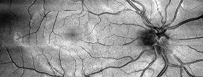 VIS-OCT has the capability to capture a full fundus image. Courtesy of Hao Zhang.