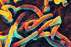 Micro-Ring Resonator Enables Fast, Accurate Ebola Virus Detection