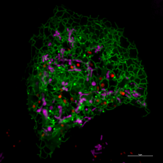 A superresolution image shows the endoplasmic reticulum in green, lysosomes in pink, and mitochondria in red. Using the light-activated proteins, the mitochondria and lysosomes are brought together to conduct mitochondrial fission. A research team used the technique of optogenetics to jump-start the fission process by bringing the lysosomes and mitochondria together within cells. Optogenetics enables precise control of specific cell functions using light. Courtesy of Jiajie Diao.
