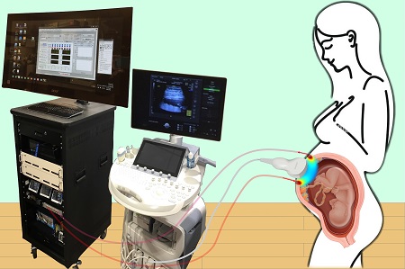 Combining optical measurements with ultrasound, an interdisciplinary team from the University of Pennsylvania’s School of Arts & Sciences and Perelman School of Medicine and the Children’s Hospital of Philadelphia developed a device to measure blood flow and oxygenation in the placenta. Courtesy of Lin Wang.