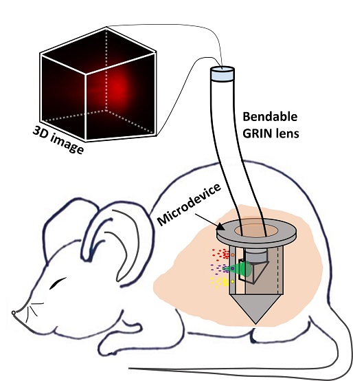 A recently developed GRIN-based endoscope is being used with an implantable microdevice designed to quickly evaluate the effectiveness of various cancer therapies. A setup using the lens that is currently being studied in mice could eventually be used in human patients to quickly figure out which treatment options are best for fighting each patient's specific tumor. Courtesy of Guigen Liu, Harvard Medical School and Brigham and Women’s Hospital.