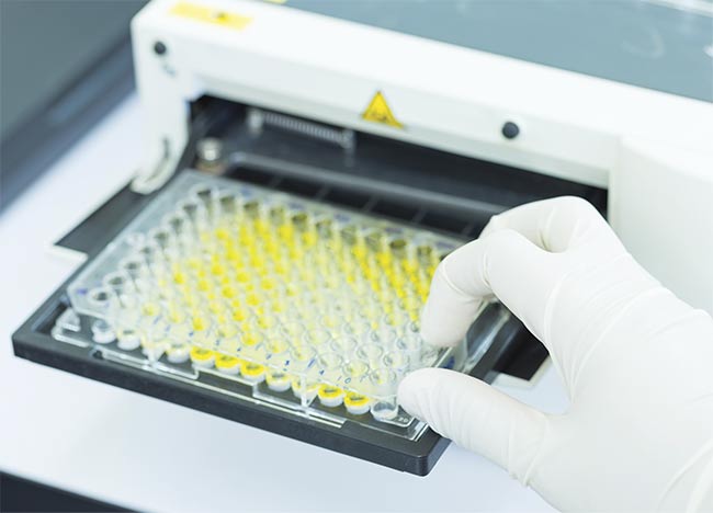 Raman spectroscopy is used in many biomedical applications, such as when analyzing the biochemical environment of cells to see how cells react to pharmaceuticals. Courtesy of Edmund Optics.