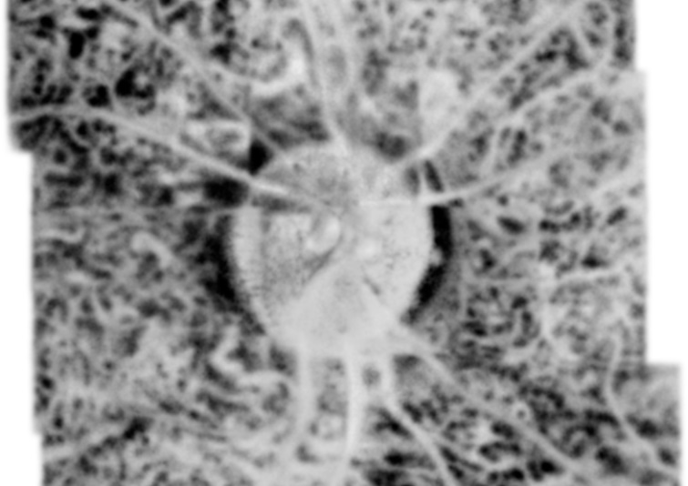 Image of a selected layer in the human choroid obtained by the new STOC-T method. Courtesy of the International Centre for Translational Eye Research (ICTER).