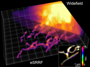 3D, live-cell, superresolution imaging with eSRRF. Mitochondria dynamics observed in U2OS cells expressing TOM20-Halo, loaded with the fluorescent marker JF54, with a multifocus microscope are super-resolved by 3D eSRRF processing of the dataset. This allows a super-resolved volumetric view of 20 × 20 × 3.6 µm3 at a rate of about 1Hz in a living cell. Courtesy of the Gulbenkian Science Institute.