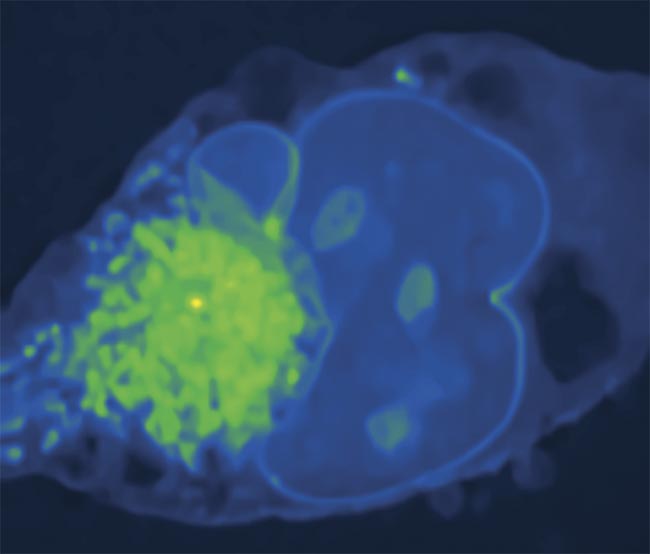 A stimulated Raman photothermal (SRP) microscopy image of a Mia PaCa-2 cell (pancreatic cancer) in glycerol-d8 (a reagent) at 2930 cm-1. Courtesy of the Cheng Lab/Boston University.