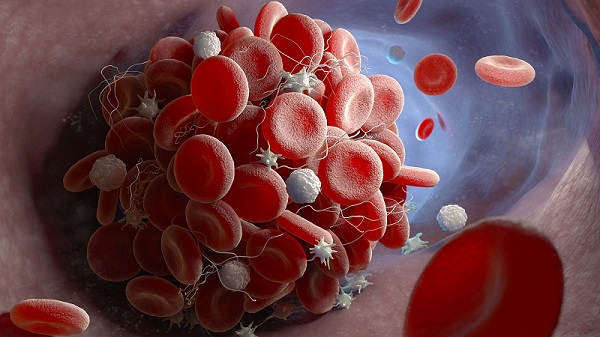 A research team from the Technical University of Munich used a method from image-based flow cytometry to rapidly analyze the interactions between large numbers of blood cells. The team identified a predictive biomarker for the risk of serious infection in COVID-19 patients. Courtesy of iStockphot.com/iLexx.