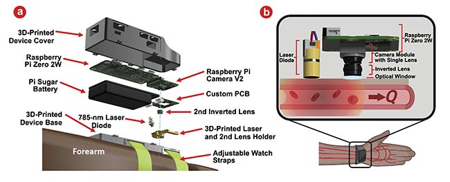 Figure 3. A full wrist-worn wearable device that was designed by the lab of Christine O’Brien at Washinton University in St. Louis (a). The design for a laser and camera system for imaging blood flow (b). Courtesy of O’Brien Lab/Washington University in St. Louis.