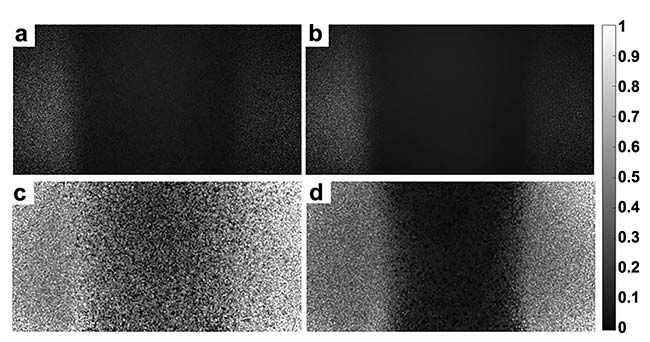 Figure 4. Captured images from the low-cost wearable and wireless laser speckle contrast imaging (LSCI) device from the O’Brien Lab. A raw speckle image in a low (a) and high (b) flow phantom tube. A speckle contrast image in a low (c) and high (d) flow phantom tube. Courtesy of O’Brien Lab/Washington University in St. Louis.