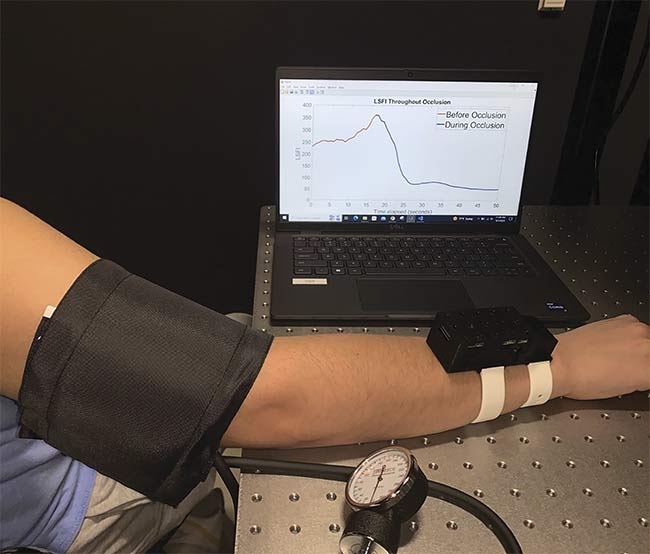 A wearable laser speckle contrast imaging (LSCI) device from Washington University in St. Louis on a human arm, recording data during arm occlusion. Courtesy of O’Brien Lab/Washington University in St. Louis.
