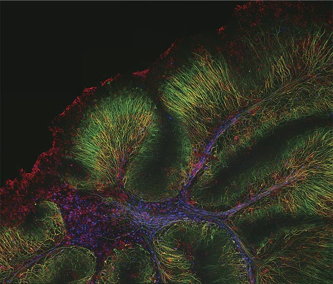 A mouse cerebellum captured on the FLUOVIEW FV4000 laser scanning confocal microscope featuring SilVIR detector technology, with neurofilament-heavy chain (green), myelin basic protein (red), and glutathione S-transferase pi 1 (blue). Fluorescence data is courtesy of Katherine Given at the University of Colorado. Image courtesy of Evident Scientific.