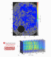 A THz spectroscopic image of a burn obtained with the PHASR Scanner by sweeping over a frequency range between 0.2 and 0.9 THz. Courtesy of Stony Brook University.