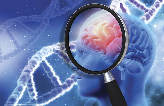 Illustration of Alzheimer’s disease research. Courtesy of iStock.com/kirstypargeter.