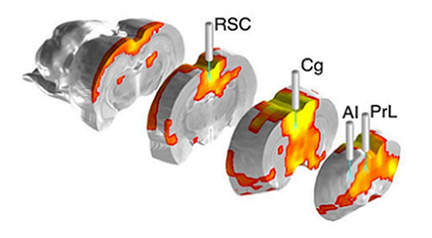 Novel Platform Reveals Insights into Large-Scale Brain Network Control