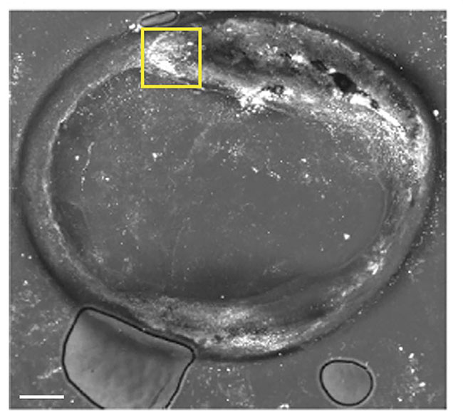 Figure 1. A mid-infrared optoacoustic microscopy image of the features of a plaque deposit at 2850 cm-1. Adapted with permission from Reference 1.
