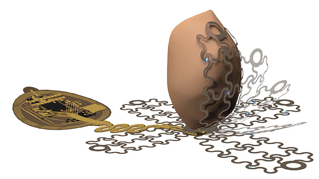 A photographic image of the cardiac interface before epicardial application. Courtesy of the Gutruf Lab.