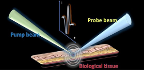 Remote Sensing Gives Photoacoustic Microscopy a Beneficial Wrinkle