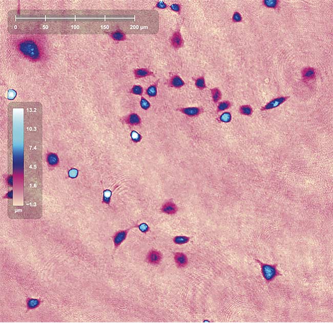 Quantitative Phase Imaging Advances Regenerative Medicine