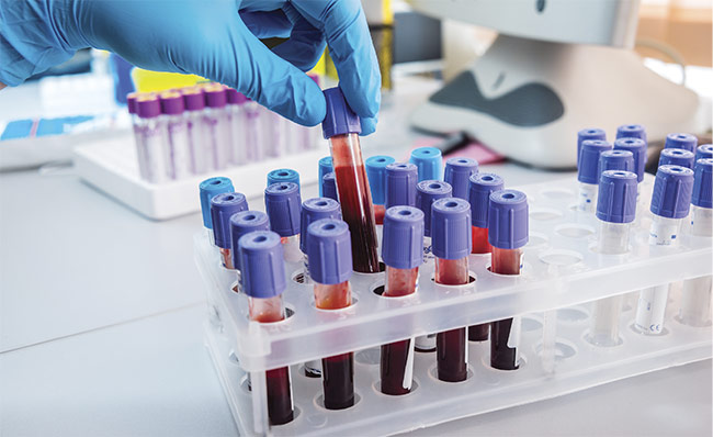 The need to test multiple blood samples at once has spawned innovation in fiber optic probes. Courtesy of Romaset — stock.adobe.com.
