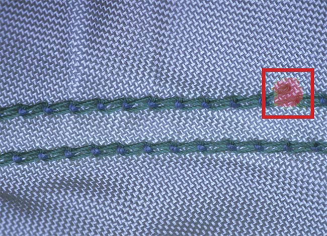 A defect in an airbag. The detection of flaws on certain backgrounds, such as fabric, can be improved by training AI with a representative image database of good and bad parts. Courtesy of Cognex.