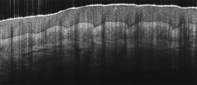 Figure 2. 800-nm spectral-domain optical coherence tomography (SD-OCT) image of a finger, showing the epidermis and dermis layers. Courtesy of Wasatch Photonics.