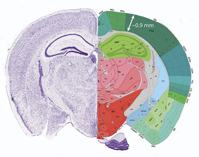 Figure 2. The effective depth limit for two-photon (2P) imaging of the live mouse brain is ~1 mm, thus restricting this method to studies of the cortex. Courtesy of the Mouse Brain Atlas/Allen Brain Institute