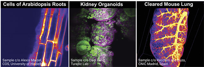 This image shows a selection of different samples imaged with selective plane illumination microscopy (SPIM), including cells of plant roots, kidney organoids, and cleared mouse lungs. Courtesy of Elisabeth Kugler.