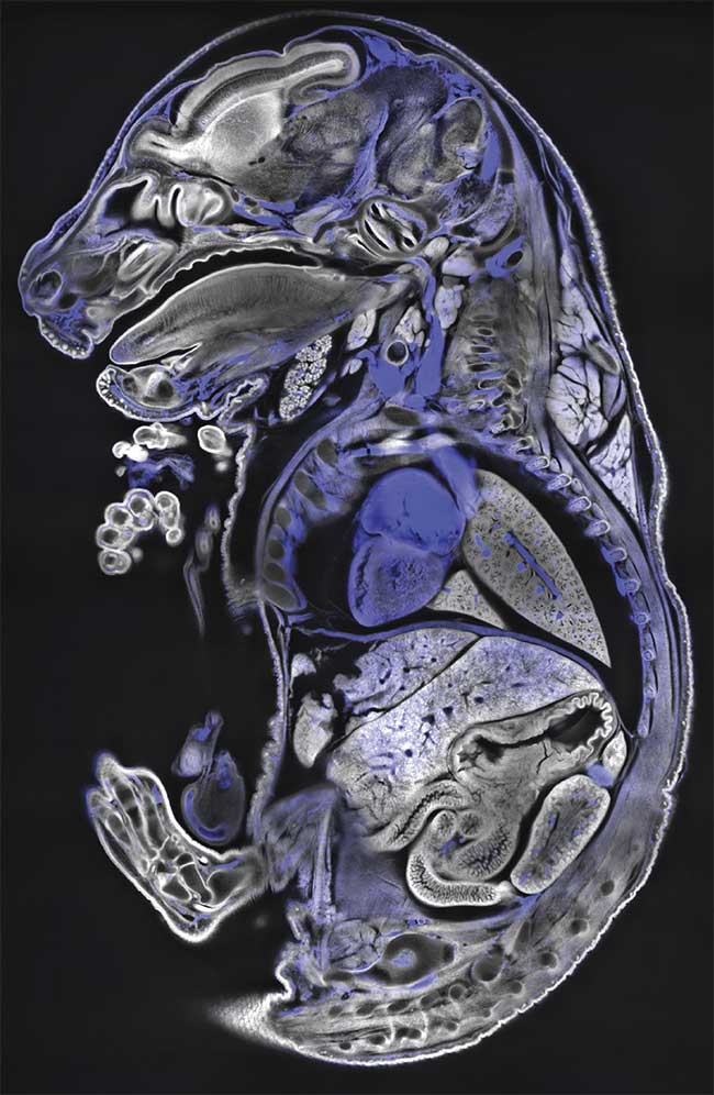 Methylene blue imaging in a mouse sample with the Bruker Luxendo LCS SPIM. Courtesy of Montserrat Coll Llado/European Molecular Biology Laboratory.