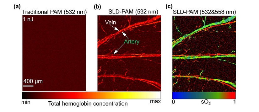 Comparison of the in vivo results of (a): Traditional-PAM, (b): SLD-PAM at super-low pulse energy with a green-light source, and (c): oxygen saturation image acquired by SLD-PAM via dual-wavelength spectrum unmixing. Courtesy of Zhang, Y. et al., https://onlinelibrary.wiley.com/doi/10.1002/advs.202302486.