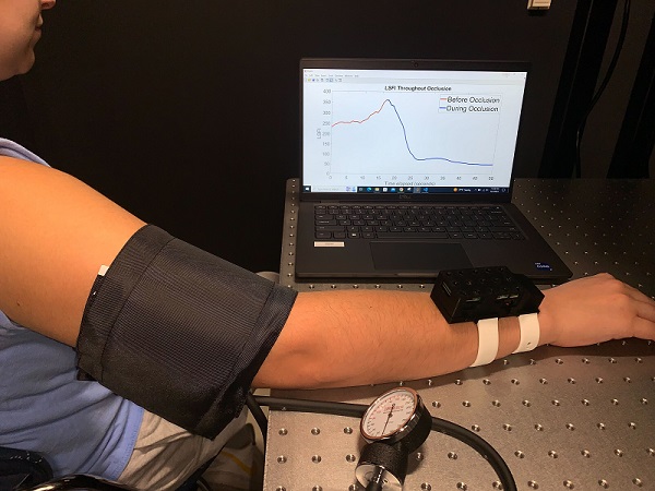 A wearable, wrist-worn device developed by Washington University uses laser speckle imaging to catch early signs of postpartum hemorrhage. Courtesy of Francesca Bonetta-Misteli, Washington University in St. Louis.