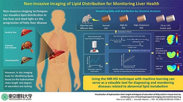 Machine Learning Hones Ability to Image Liver Disease