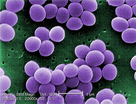 A research group at the University of São Paulo’s Optics and Photonics Research Center analyzed patient samples containing <I>Staphylococcus aureus</I>, a bacterium that causes a range of diseases, from skin infections to pneumonia. Courtesy of Janice Haney Carr/CDC PHIL.