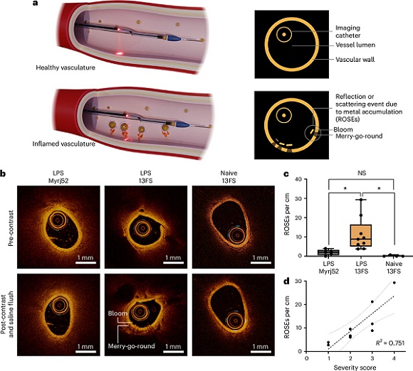 In vivo IV-OCT molecular imaging of intravascular inflammation with AuSC@(13FS)2. Courtesy of Nature Nanotechnology (2024). DOI: 10.1038/s41565-024-01802-2.