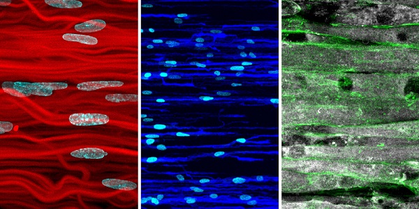 The image shows hydrogel scaffolds and cells that can be used to produce (from left to right) connective tissue, nerve tissue, and muscle tissue. Courtesy of ETH Zurich.